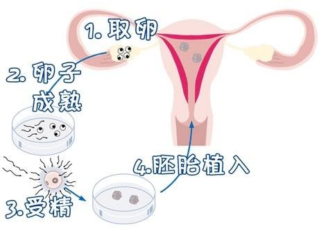 医疗团队